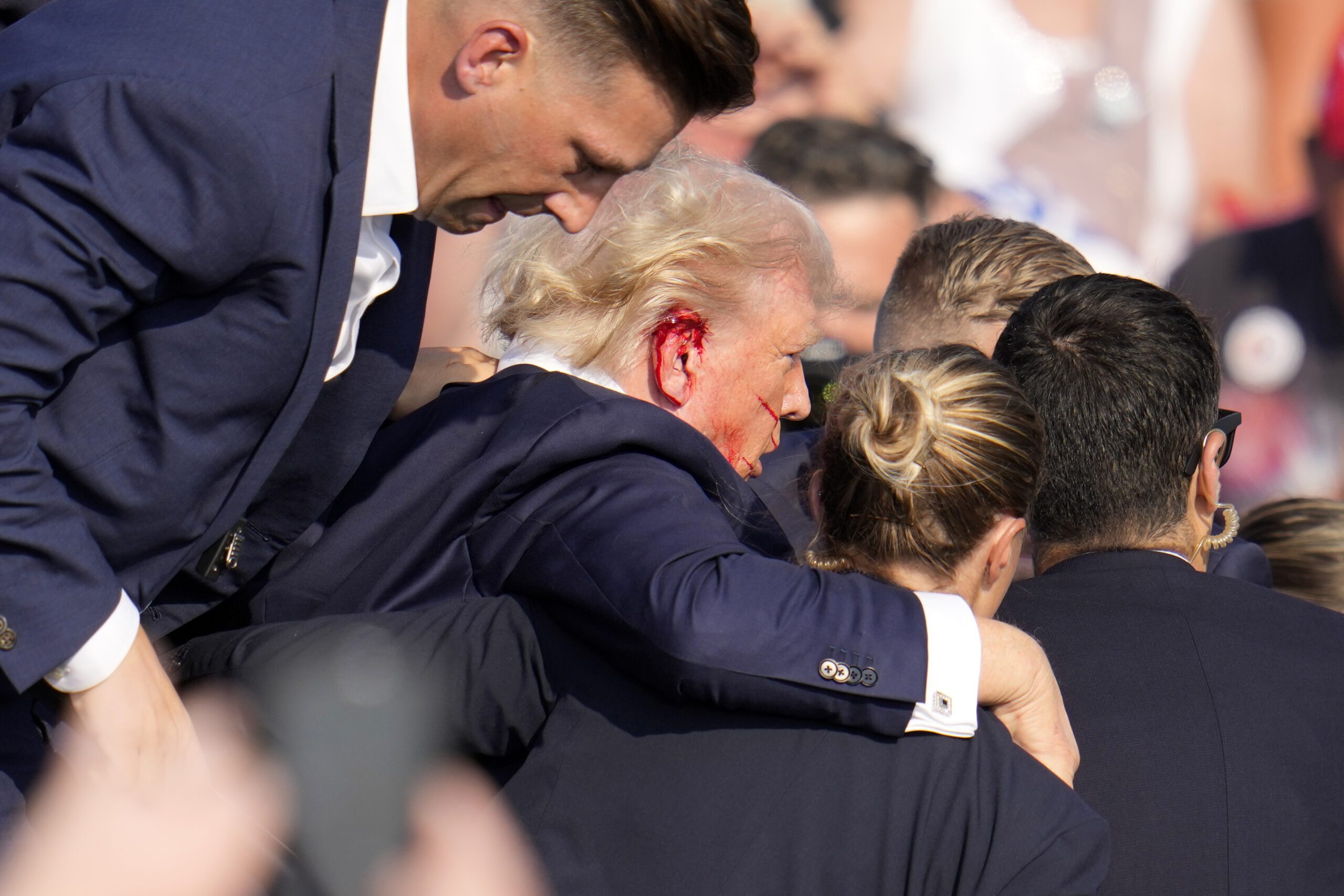 TRUMP BLIODY EAR